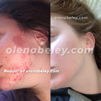 SKIN HEALING