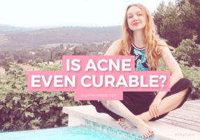 best acne blog on the internet, trustworth skin health advice, how to get rid of acne