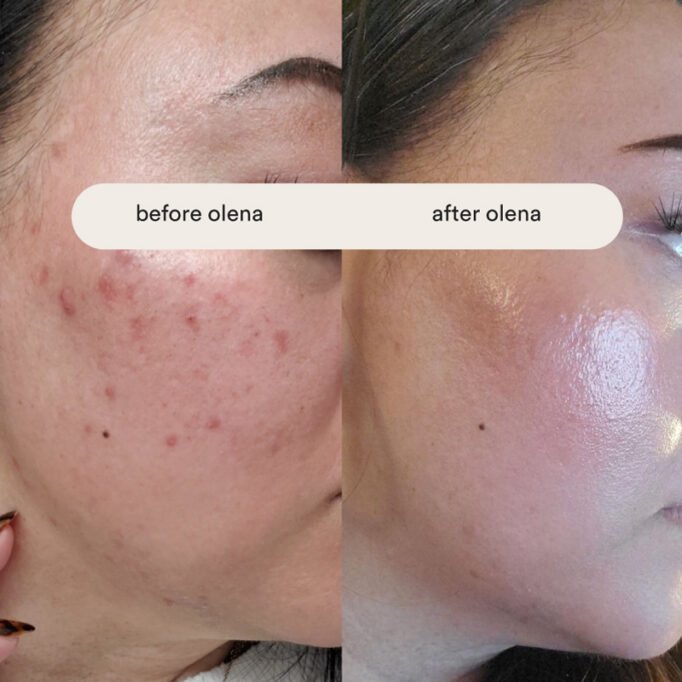olena-beley-routine-review-client-results,-how-to-get-clearer-skin-with-skincare