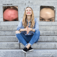 beauty myths, detox myth, lemon bad for skin, overexfoliation, olena beley, pop the pimple