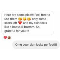 acne-prone skin before and after, popthepimple, best acne blog, acne healing results